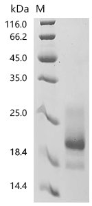 Recombinant Human Tumor necrosis factor receptor superfamily member 10A (TNFRSF10A), partial (Active), Homo sapiens (Human), Mammalian cell, C-terminal 10xHis-tagged, 24.2 kDa, purity >95% as determined by SDS-PAGE.Greater than 95% as determined by SEC-HPLC.