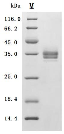 Recombinant Human Epithelial cell adhesion molecule (EPCAM), partial (Active), Homo sapiens (Human), Mammalian cell, C-terminal 10xHis-tagged, 28.8 kDa, purity >95% as determined by SDS-PAGE.
