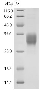Recombinant Mouse T-cell surface glycoprotein CD8 alpha chain (Cd8a), partial (Active), Mus musculus (Mouse), Mammalian cell, C-terminal 10xHis-tagged, 20.3 kDa, purity >95% as determined by SDS-PAGE.
