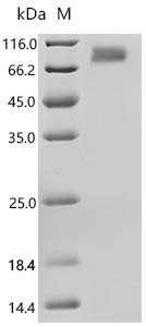 Recombinant Human Hepatitis A virus cellular receptor 1 (HAVCR1), partial (Active), Homo sapiens (Human), Mammalian cell, N-terminal 10xHis-tagged, 30.9 kDa, purity >95% as determined by SDS-PAGE.