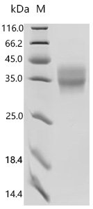 Recombinant Human C-type lectin domain family 5 member A (CLEC5A), partial (Active), Homo sapiens (Human), Mammalian cell, N-terminal 10xHis-tagged, 24.6 kDa, purity >95% as determined by SDS-PAGE.Greater than 95% as determined by SEC-HPLC.
