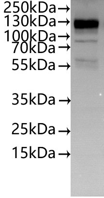 Recombinant Human Interleukin-10 receptor subunit alpha (IL10RA)-VLPs (Active), Homo sapiens (Human), Mammalian cell, C-terminal 10xHis-tagged, 62.2 kDa, purity >/