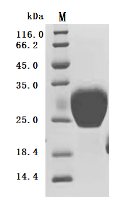 Recombinant Human Leukocyte-associated immunoglobulin-like receptor 1 (LAIR1), partial (Active), Homo sapiens (Human), Mammalian cell, C-terminal 10xHis-tagged, 16.9 kDa, purity >95% as determined by SDS-PAGE.Greater than 95% as determined by SEC-HPLC.