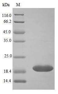 Recombinant Human Neutrophil gelatinase-associated lipocalin (LCN2) (Active), Homo sapiens (Human), E.Coli, Tag-Free, 20.5 kDa, purity >>95% as determined by SDS-PAGE.