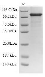Recombinant Human ATP-binding cassette sub-family D member 1 (ABCD1) (Active), Homo sapiens (Human), in vitro E.coli expression system, C-terminal 10xHis-tagged, 84.9kDa, purity >90% as determined by SDS-PAGE.