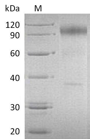 Recombinant Human Interleukin-23 receptor (IL23R), partial (Active), Homo sapiens (Human), Mammalian cell, C-terminal hFc-tagged, 65 kDa, purity >90% as determined by SDS-PAGE.