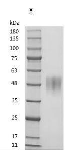 Recombinant Human Pro-neuregulin-1, membrane-bound isoform (NRG1),Partial (Active), Homo sapiens (Human), Mammalian cell, Tag free, 24.2 kDa, purity >95% as determined by SDS-PAGE.