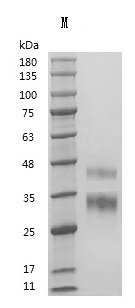 Recombinant Human R-spondin-1 (RSPO1) (Active), Homo sapiens (Human), Mammalian cell, Tag free, 26.7 kDa, purity >95% as determined by SDS-PAGE.