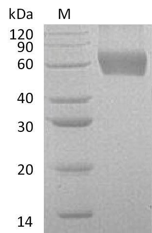 Recombinant Human Granulocyte-macrophage colony-stimulating factor receptor subunit alpha (CSF2RA), partial (Active), Homo sapiens (Human), Mammalian cell, C-terminal 6xHis-tagged, 35.5 kDa, purity >95% as determined by SDS-PAGE.