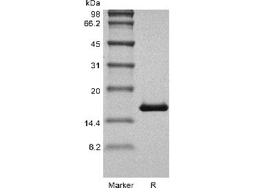 Recombinant Human Basic Fibroblast Growth Factor (FGF2), partial (Active) (GMP), Homo sapiens (Human), E.Coli, Tag-Free, 16.5 kDa, purity >> 98 % by SDS-PAGE and HPLC analyses.