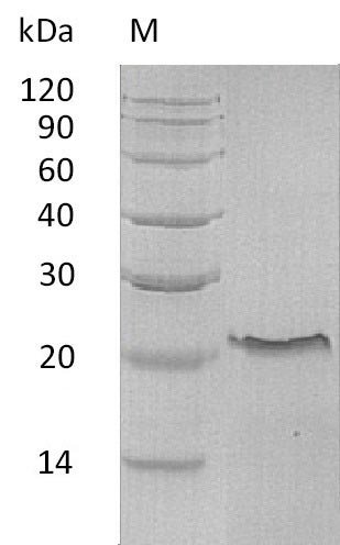 Recombinant Human Tumor necrosis factor receptor superfamily member 1A (TNFRSF1A), partial (Active), Homo sapiens (Human), E.coli, N-terminal 6xHis-tagged, 23.5 kDa, purity >95% as determined by SDS-PAGE.
