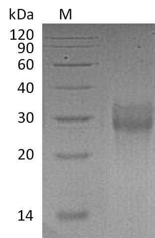 Recombinant Human Tumor necrosis factor receptor superfamily member 9 (TNFRSF9), partial (Active), Homo sapiens (Human), Mammalian cell, C-terminal 6xHis-tagged, 18.1 kDa, purity >95% as determined by SDS-PAGE.