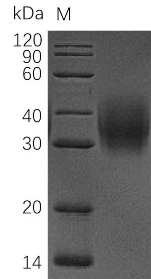 Recombinant Human Leukocyte surface antigen CD47 (CD47), partial (Active), Homo sapiens (Human), Mammalian cell, C-terminal 6xHis-tagged, 14.76 kDa, purity >95% as determined by SDS-PAGE.