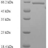 Human Lys-63-specific deubiquitinase BRCC36 (BRCC3) Recombinant Protein, N-His-GST - BioCrest Sci