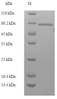 Human Lys-63-specific deubiquitinase BRCC36 (BRCC3) Recombinant Protein, N-His-GST, Homo sapiens (Human), E.coli, N-terminal 6xHis-GST-tagged, 65.9 kDa, purity >≥ 90% as determined by SDS-PAGE.