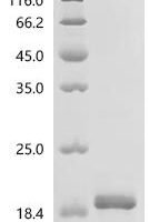 Mouse High affinity copper uptake protein 1 (Slc31a1), partial Recombinant Protein - BioCrest Sci