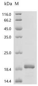 Mouse High affinity copper uptake protein 1 (Slc31a1), partial Recombinant Protein, Mus musculus (Mouse), E.coli, C-terminal 6xHis-tagged, 15.3 kDa, purity >≥ 90% as determined by SDS-PAGE.