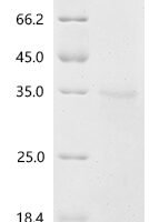 Human Deoxyribonuclease-1 (DNASE1) Recombinant Protein, C-His - BioCrest Sci
