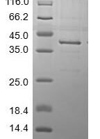 Human Alkaline phosphatase, placental type (ALPP), partial Recombinant Protein - BioCrest Sci