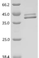 Human Interleukin-12 subunit beta (IL12B) Recombinant Protein, C-10His - BioCrest Sci