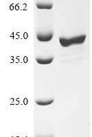 Mouse Fos-related antigen 1 (Fosl1) Recombinant Protein, N-10His/C-Myc - BioCrest Sci