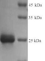Escherichia coli Ribose-5-phosphate isomerase A (rpiA) Recombinant Protein, Tag-Free - BioCrest Sci