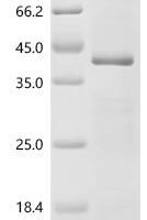 Mouse Aryl hydrocarbon receptor (Ahr), partial Recombinant Protein - BioCrest Sci
