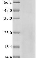 Human Broad substrate specificity ATP-binding cassette transporter ABCG2 (ABCG2), partial Recombinant Protein - BioCrest Sci