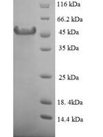 Human Hyaluronan-binding protein 2 (HABP2), partial Recombinant Protein, N-His-SUMO, aa 37–313 - BioCrest Sci
