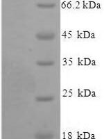 Human Xaa-Pro aminopeptidase 1 (XPNPEP1) Recombinant Protein - BioCrest Sci
