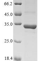 Chlorobium tepidum Polyphosphate kinase 2 (ppk2), partial Recombinant Protein - BioCrest Sci