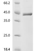 Human Chitinase domain-containing protein 1 (CHID1) Recombinant Protein, N-His, aa 20–393, Mammalian cell - BioCrest Sci