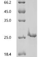 Human TATA-binding protein-associated factor 2N (TAF15), partial Recombinant Protein, N-10His, aa 1–119 - BioCrest Sci