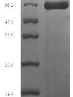 Mouse Perforin-1 (Prf1) Recombinant Protein - BioCrest Sci