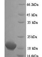 Human Clathrin heavy chain 2 (CLTCL1), partial Recombinant Protein - BioCrest Sci