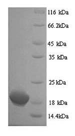 Human Clathrin heavy chain 2 (CLTCL1), partial Recombinant Protein, Homo sapiens (Human), Yeast, N-terminal 6xHis-tagged, 18.8 kDa, purity >≥ 90% as determined by SDS-PAGE.