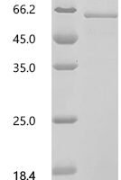 Human Transcription factor E2F3 (E2F3) Recombinant Protein - BioCrest Sci