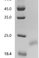 Human Interleukin-17F (IL17F) Recombinant Protein, N-10His - BioCrest Sci