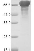 Saccharomyces cerevisiae Acetyl-CoA carboxylase (ACC1), partial Recombinant Protein, N-10His, aa 2–581 - BioCrest Sci