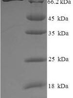 Human Histone deacetylase 1 (HDAC1) Recombinant Protein - BioCrest Sci