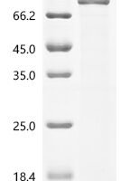 Human Nucleosome assembly protein 1-like 1 (NAP1L1) Recombinant Protein, C-hFc1 - BioCrest Sci