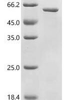 Drosophila pseudoobscura pseudoobscura Neutral ceramidase (CDase), partial Recombinant Protein - BioCrest Sci