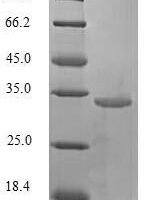 Human Trefoil factor 1 (TFF1) Recombinant Protein, N-GST - BioCrest Sci