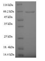 Human 5'-3' exonuclease PLD4 (PLD4), partial Recombinant Protein - BioCrest Sci