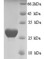 Human Prestin (SLC26A5), partial Recombinant Protein - BioCrest Sci