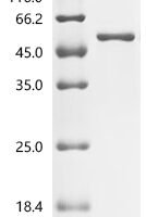 Macaca fascicularis Dipeptidase 3 (DPEP3) Recombinant Protein, C-His, aa 36–463, E.coli - BioCrest Sci