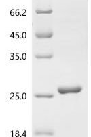 Human Cytidine deaminase (CDA) Recombinant Protein, C-His - BioCrest Sci