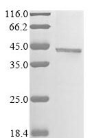 Mouse Alpha-2-macroglobulin receptor-associated protein (Lrpap1), partial Recombinant Protein, N-GFP/C-His, aa 248–360 (H294F,H296F,Y297C,H305F), Mammalian cell - BioCrest Sci