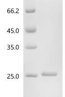 Human Serum amyloid P-component (APCS) Recombinant Protein - BioCrest Sci