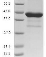 Human Neurotrophic factor BDNF precursor form (BDNF), partial Recombinant Protein - BioCrest Sci